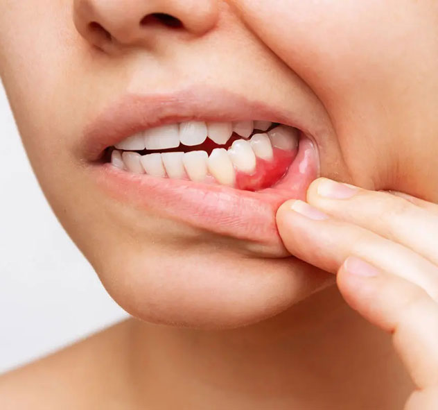 There's now a gap in my teeth and my gums are swollen - what should I do? There's now a gap in my teeth and my gums are swollen - what should I do?
