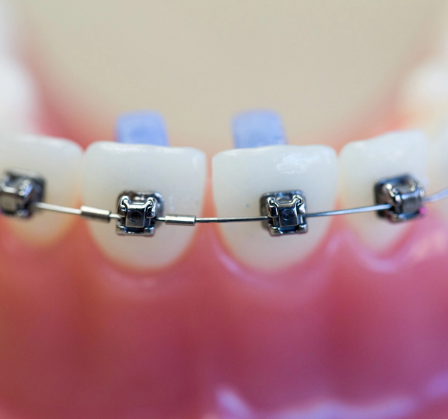 What if I have a loose bracket or broken hook? What if I have a loose bracket or broken hook?