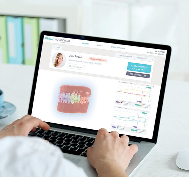 What is Dental Monitoring? What is Dental Monitoring?
